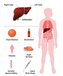 causes