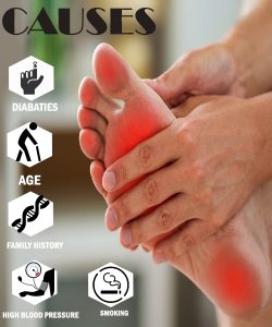 causes