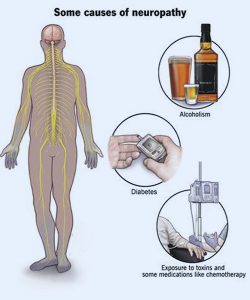 causes