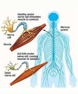 causes