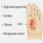 causes causes