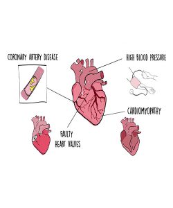 causes