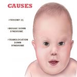 causes