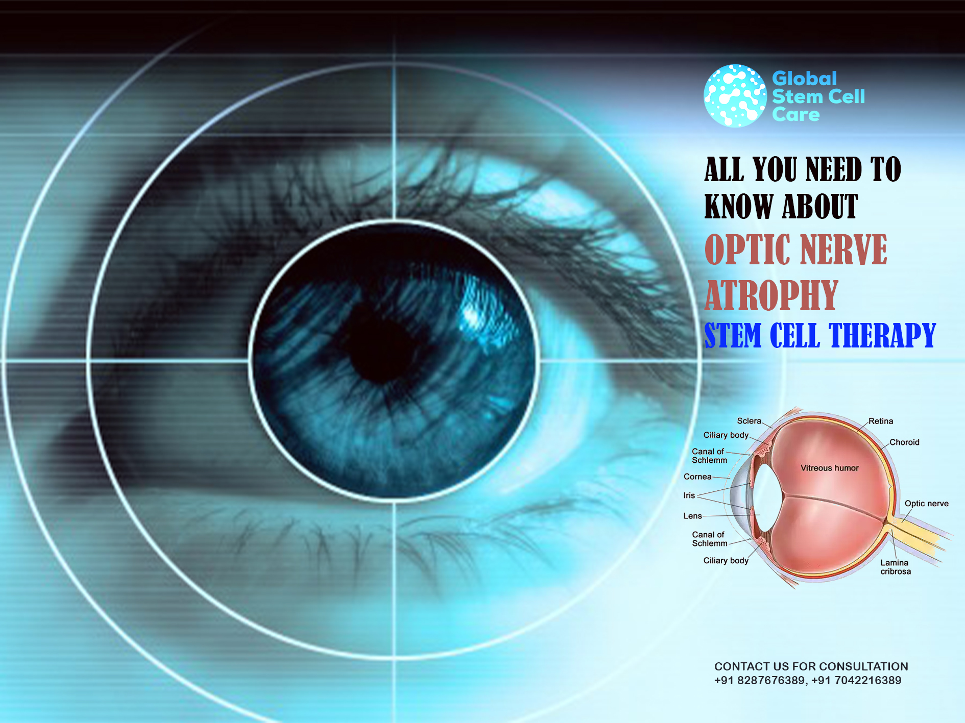 All You Need to Know About Optic Nerve Atrophy Stem Cell Therapy