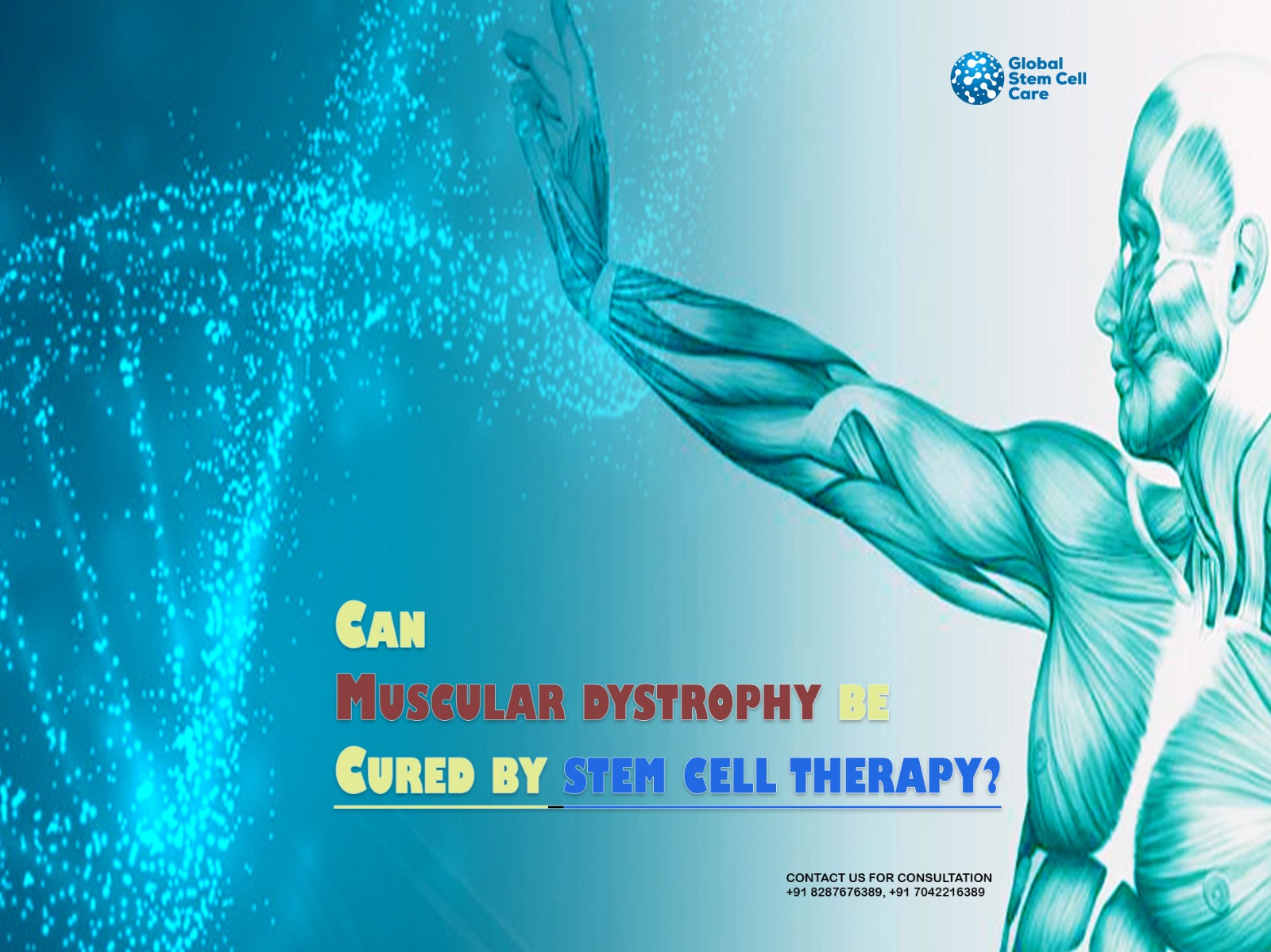 Can Muscular Dystrophy Be Cured by Stem Cell Therapy?