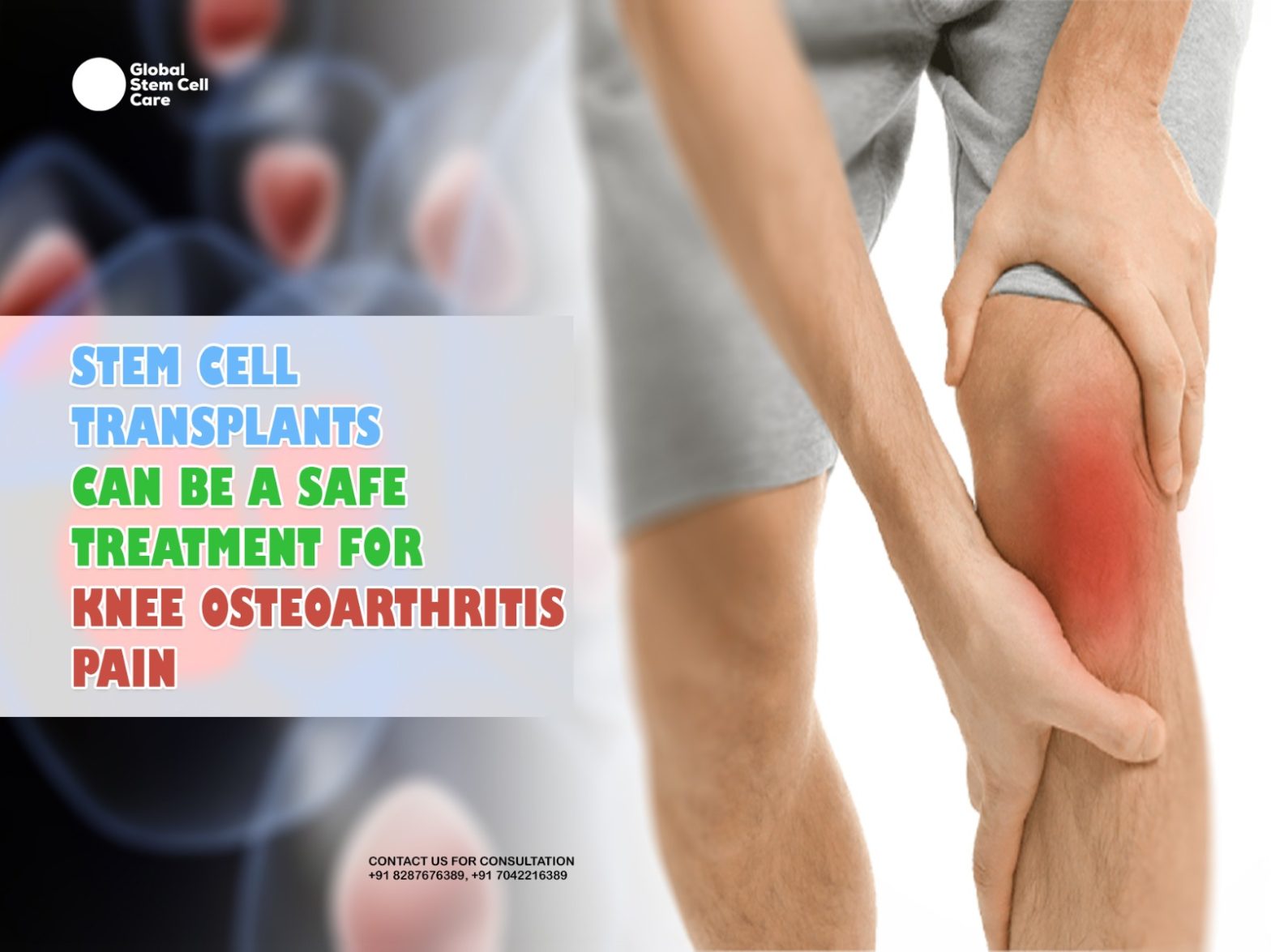 Stem Cell Transplants Can Be a Safe Treatment for Knee Osteoarthritis Pain