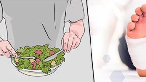 Diabetic-Foot-Ulcers