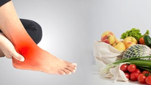Neuropathy