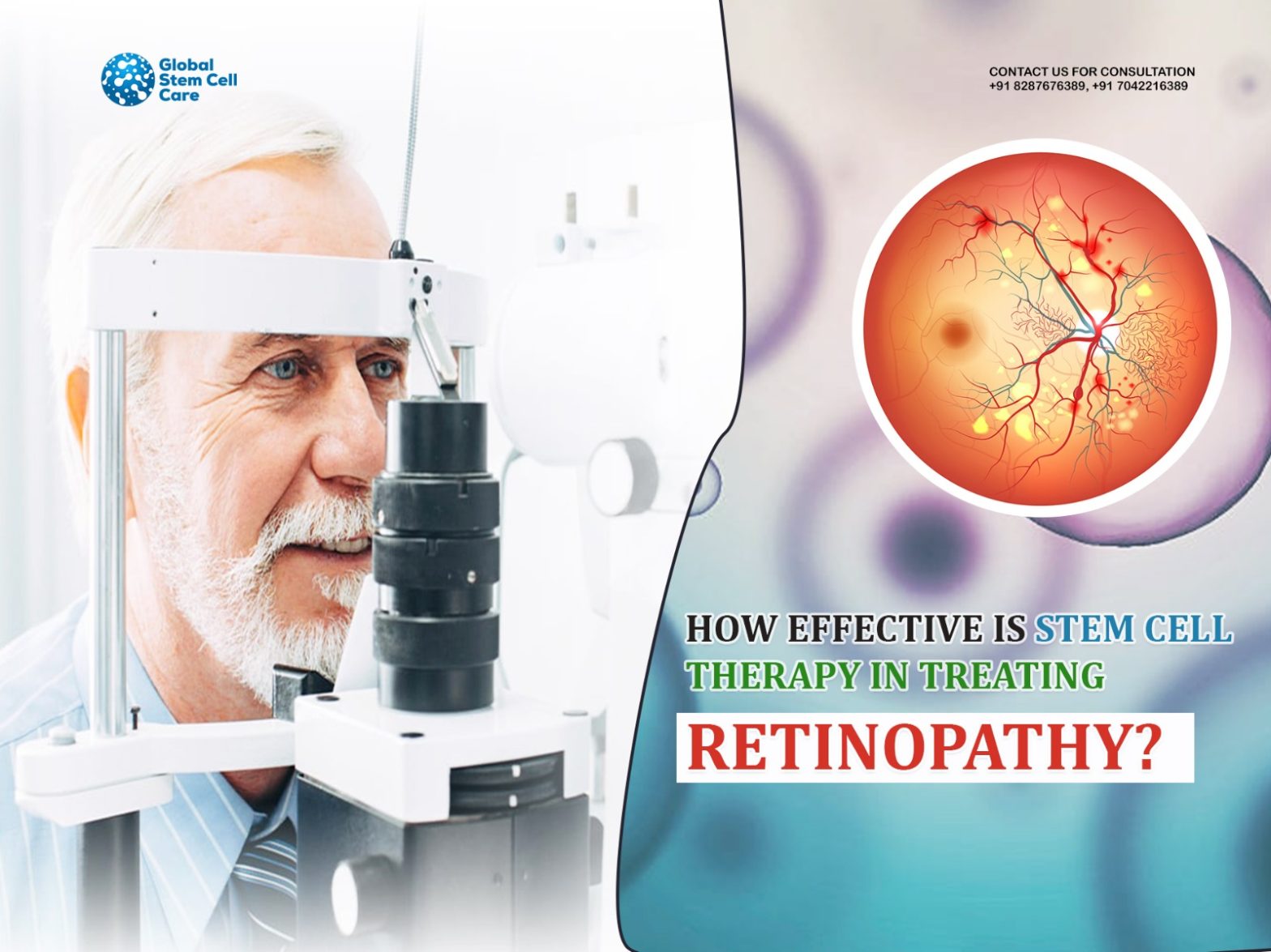 How Effеctivе is Stеm Cеll Thеrapy in Trеating Rеtinopathy?