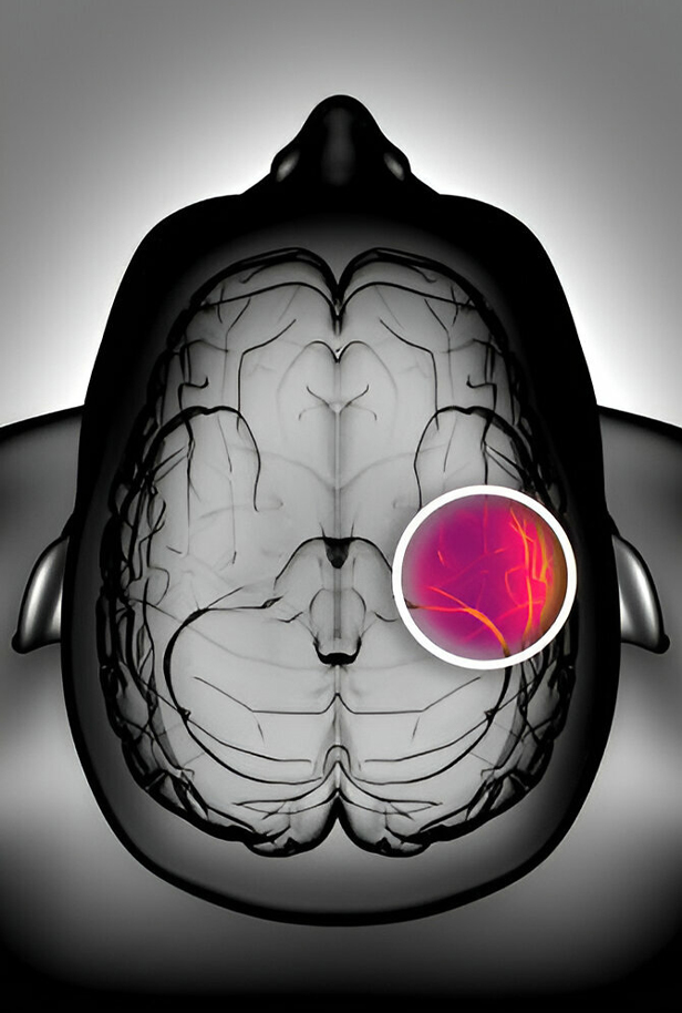 Breakthrough Stem Cell Treatment for Brain Injury