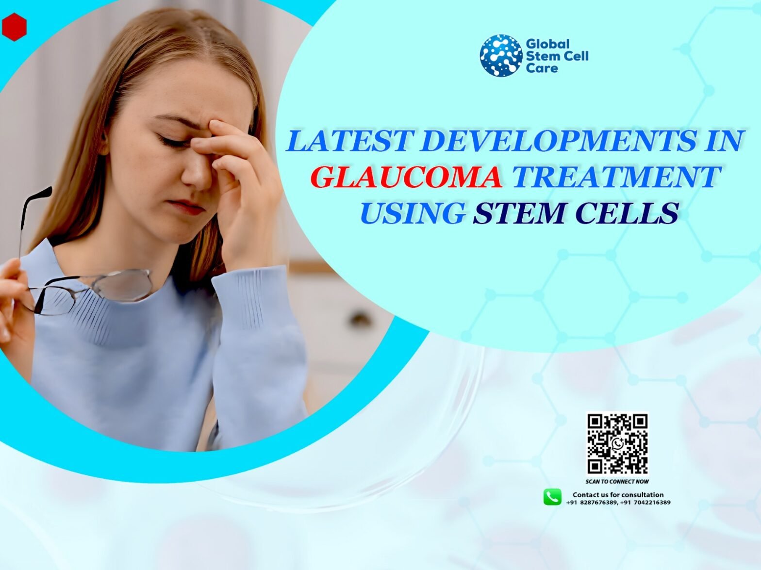Latest Developments in Glaucoma Treatment Using Stem Cells