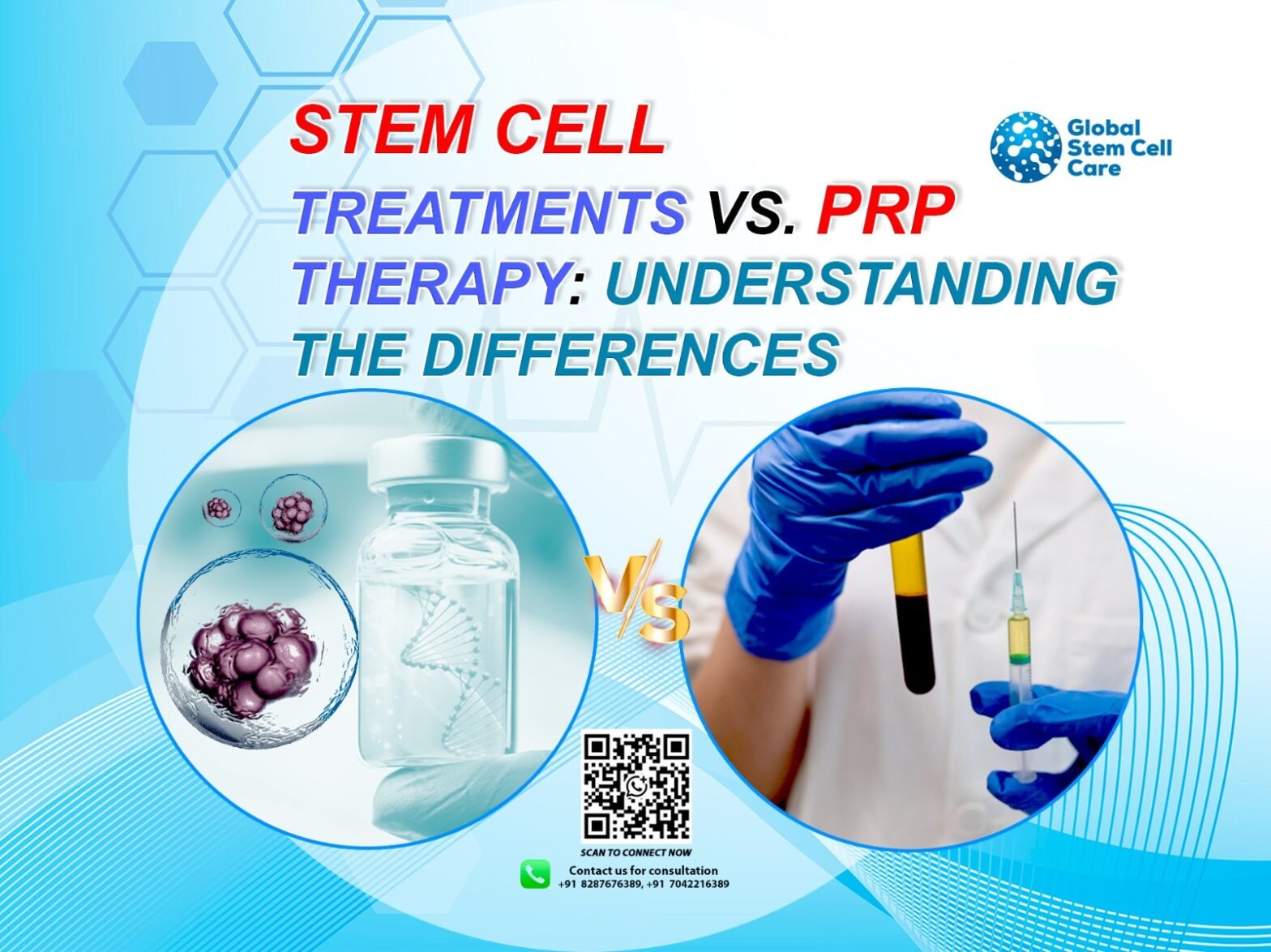 Stem Cell Treatments vs. PRP Therapy: Understanding the Differences
